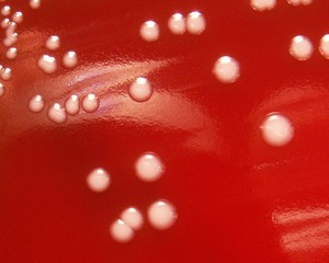 staphylococcus epidermidis colonies on agar